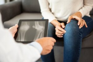 MRI of the knee before genicular artery embolization in Houston, TX 