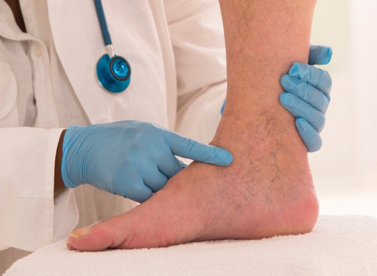Vein and Vascular Specialist in Houston, TX