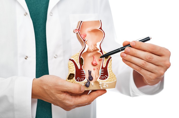 Causes of Hemorrhoidal Disease Causes of Hemorrhoidal Disease in Houston, TX